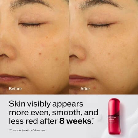 SHISEIDO Ultimune Power Infusing Serum - Anti-Aging & Radiance Boosting Serum