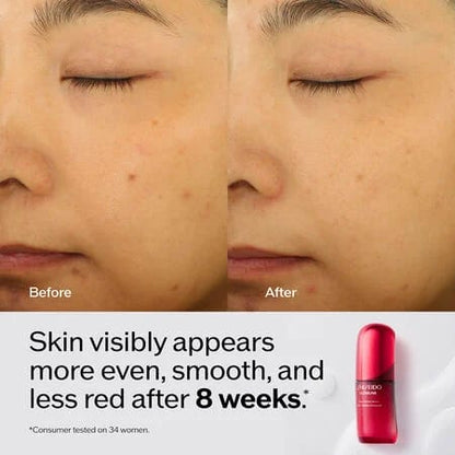 SHISEIDO Ultimune Power Infusing Serum - Anti-Aging & Radiance Boosting Serum